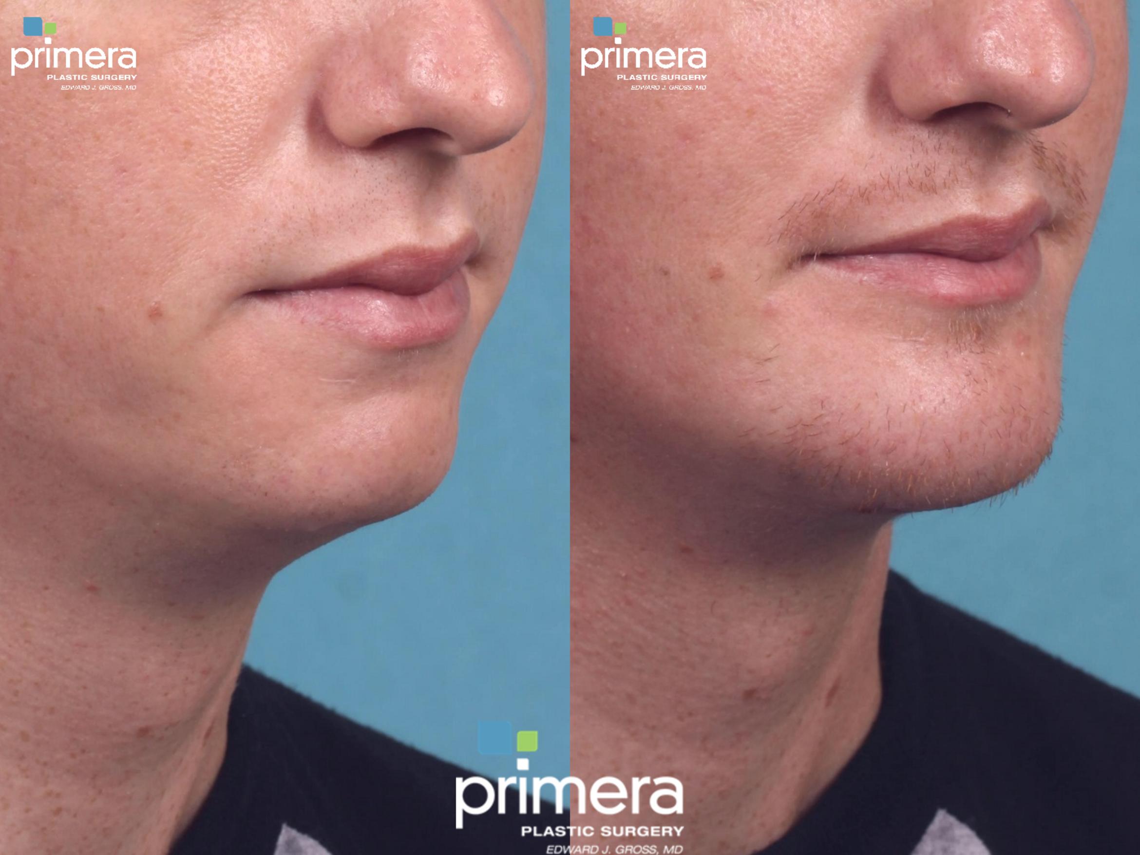 Primera Plastic Surgery